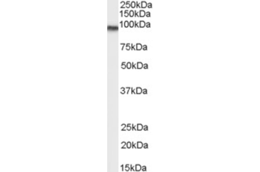 Western Blot - Anti-Transglutaminase 2 Antibody (A83205) - Antibodies.com