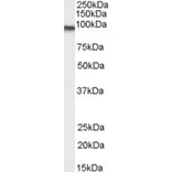 Western Blot - Anti-Transglutaminase 2 Antibody (A83205) - Antibodies.com