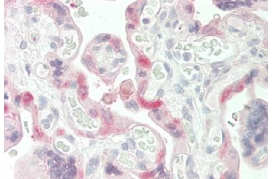 Immunohistochemistry - Anti-Transglutaminase 2 Antibody (A83205) - Antibodies.com