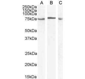 Western Blot - Anti-TAK1 Antibody (A83207) - Antibodies.com