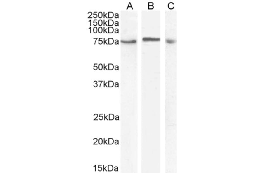 Western Blot - Anti-TAK1 Antibody (A83207) - Antibodies.com