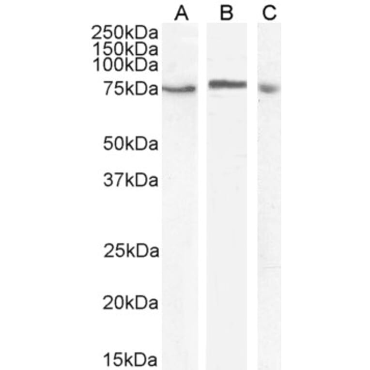 Western Blot - Anti-TAK1 Antibody (A83207) - Antibodies.com