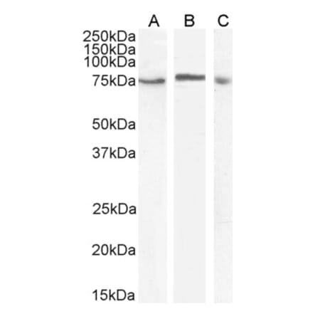 Western Blot - Anti-MAP3K 7 Antibody (A83207)