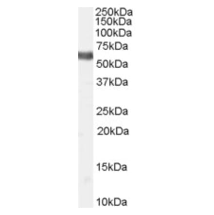 Western Blot - Anti-NUR77 Antibody (A83208) - Antibodies.com