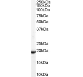 Western Blot - Anti-GPX4 Antibody (A83209) - Antibodies.com