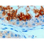 Immunohistochemistry - Anti-Glutathione Peroxidase 4 Antibody (A83209) - Antibodies.com