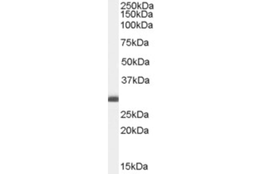 Western Blot - Anti-BAP31 Antibody (A83210) - Antibodies.com