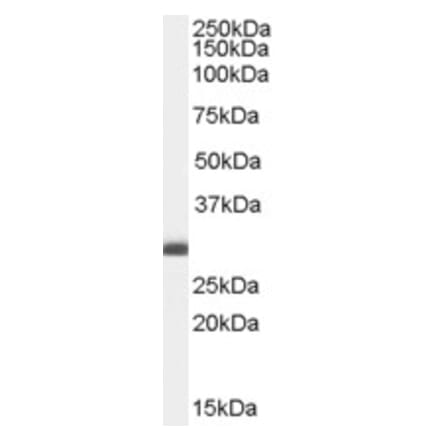 Western Blot - Anti-BAP31 Antibody (A83210) - Antibodies.com