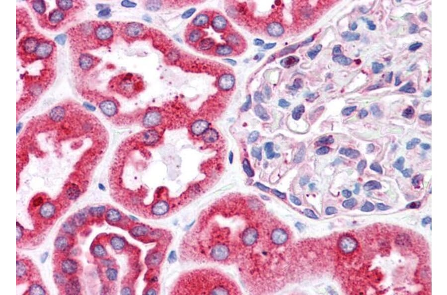 Immunohistochemistry - Anti-BAP31 Antibody (A83210) - Antibodies.com