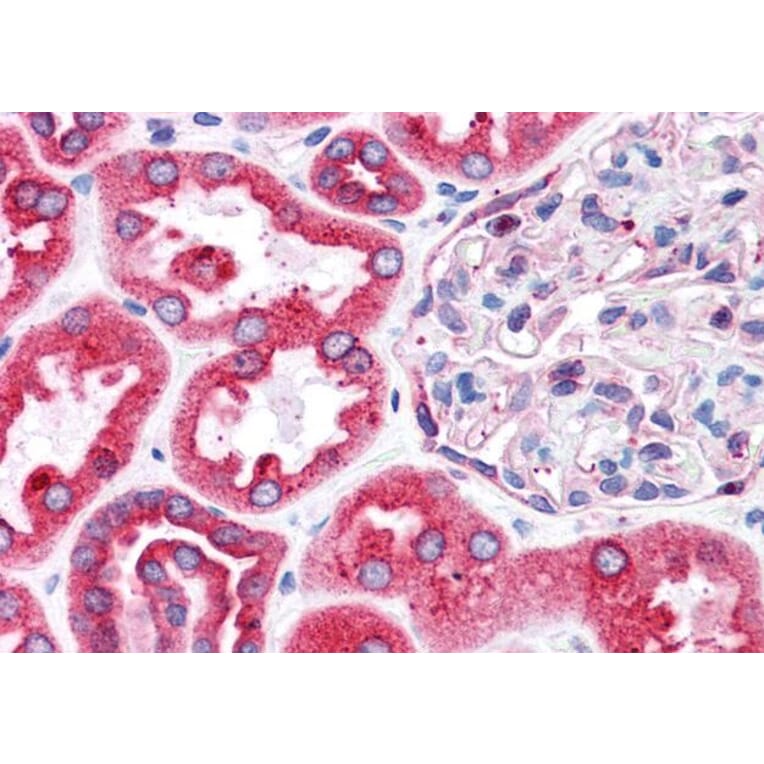 Immunohistochemistry - Anti-BAP31 Antibody (A83210) - Antibodies.com