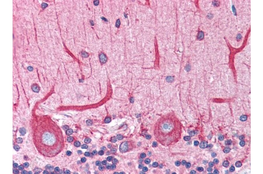 Immunohistochemistry - Anti-BAP31 Antibody (A83210) - Antibodies.com