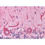 Immunohistochemistry - Anti-BAP31 Antibody (A83210) - Antibodies.com
