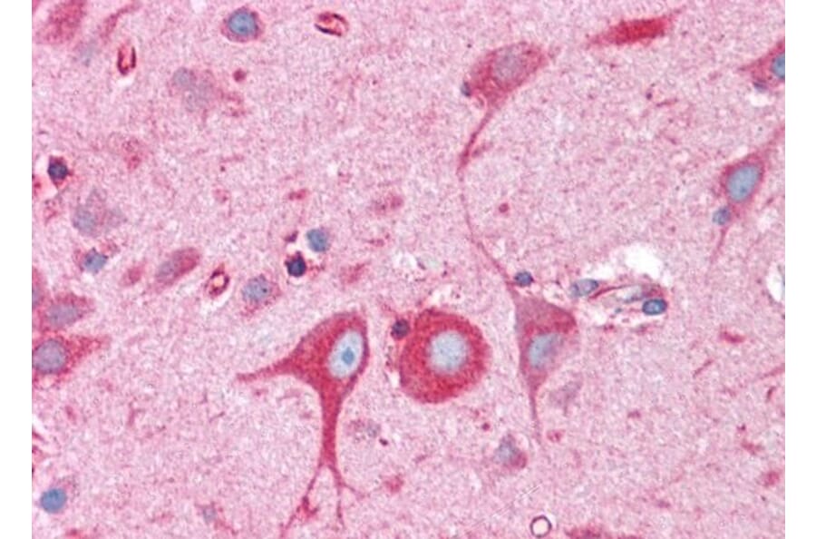 Immunohistochemistry - Anti-BAP31 Antibody (A83210) - Antibodies.com