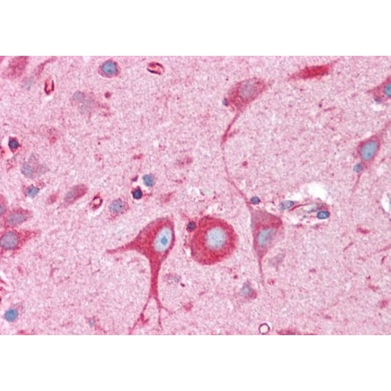 Immunohistochemistry - Anti-BAP31 Antibody (A83210) - Antibodies.com