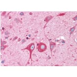 Immunohistochemistry - Anti-BAP31 Antibody (A83210) - Antibodies.com