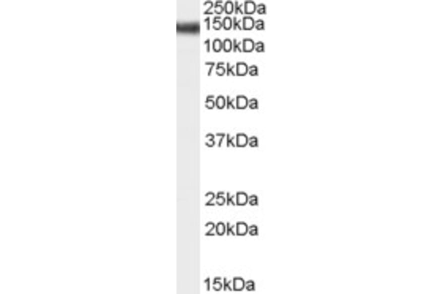 Western Blot - Anti-STAG2 Antibody (A83211) - Antibodies.com
