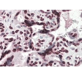 Immunohistochemistry - Anti-HMGA1a / HMGA1b Antibody (A83212) - Antibodies.com