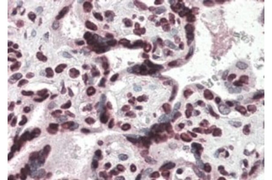 Immunohistochemistry - Anti-HMGA1a / HMGA1b Antibody (A83212) - Antibodies.com