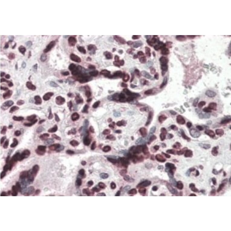 Immunohistochemistry - Anti-HMGA1a / HMGA1b Antibody (A83212) - Antibodies.com