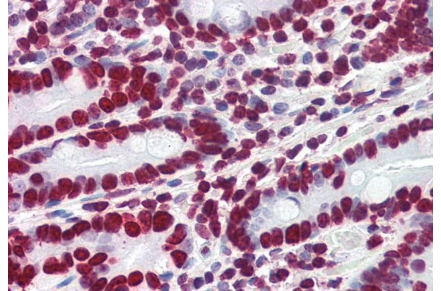 Immunohistochemistry - Anti-HMGA1a / HMGA1b Antibody (A83212) - Antibodies.com