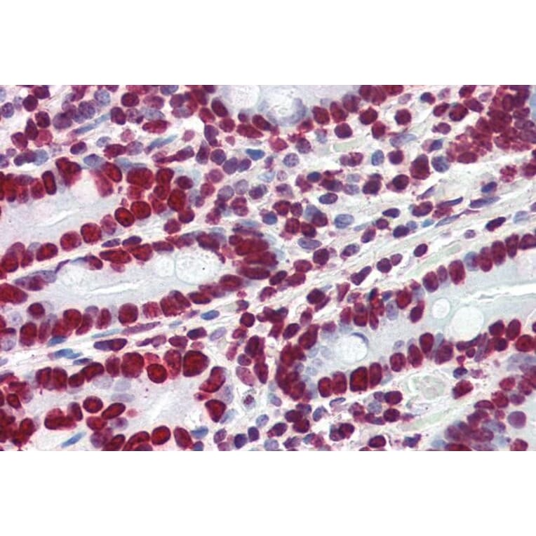 Immunohistochemistry - Anti-HMGA1a / HMGA1b Antibody (A83212) - Antibodies.com