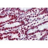 Immunohistochemistry - Anti-HMGA1a / HMGA1b Antibody (A83212) - Antibodies.com