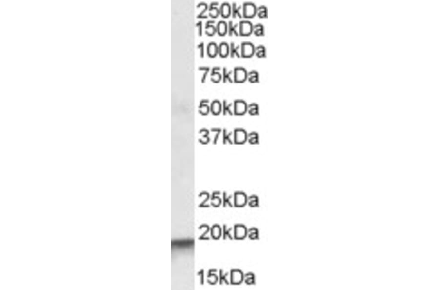 Western Blot - Anti-ARPC4 Antibody (A83213) - Antibodies.com