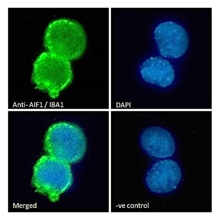 Immunofluorescence - Anti-Iba1 Antibody (A83214) - Antibodies.com