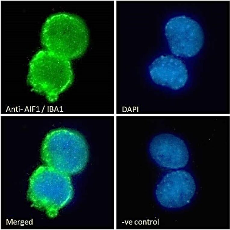 Immunofluorescence - Anti-Iba1 Antibody (A83214) - Antibodies.com