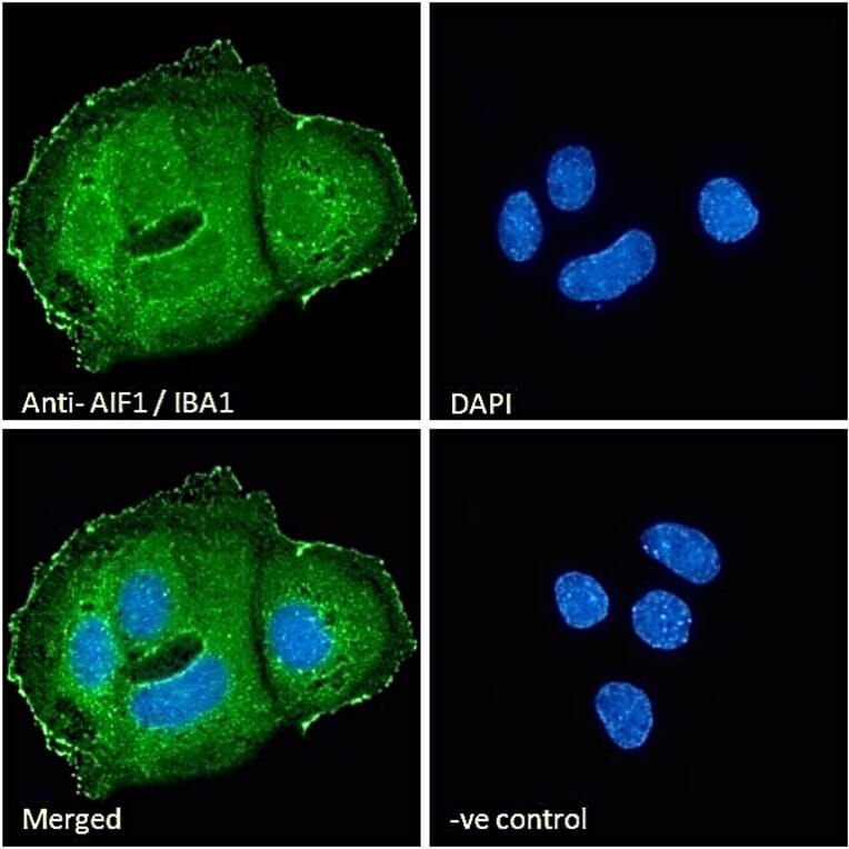 Immunofluorescence - Anti-Iba1 Antibody (A83214) - Antibodies.com