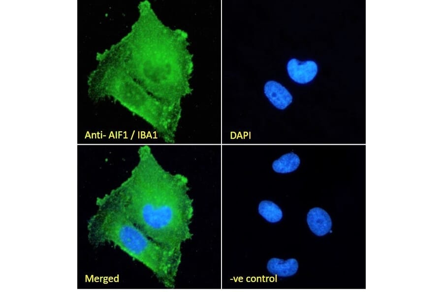 Immunofluorescence - Anti-Iba1 Antibody (A83214) - Antibodies.com