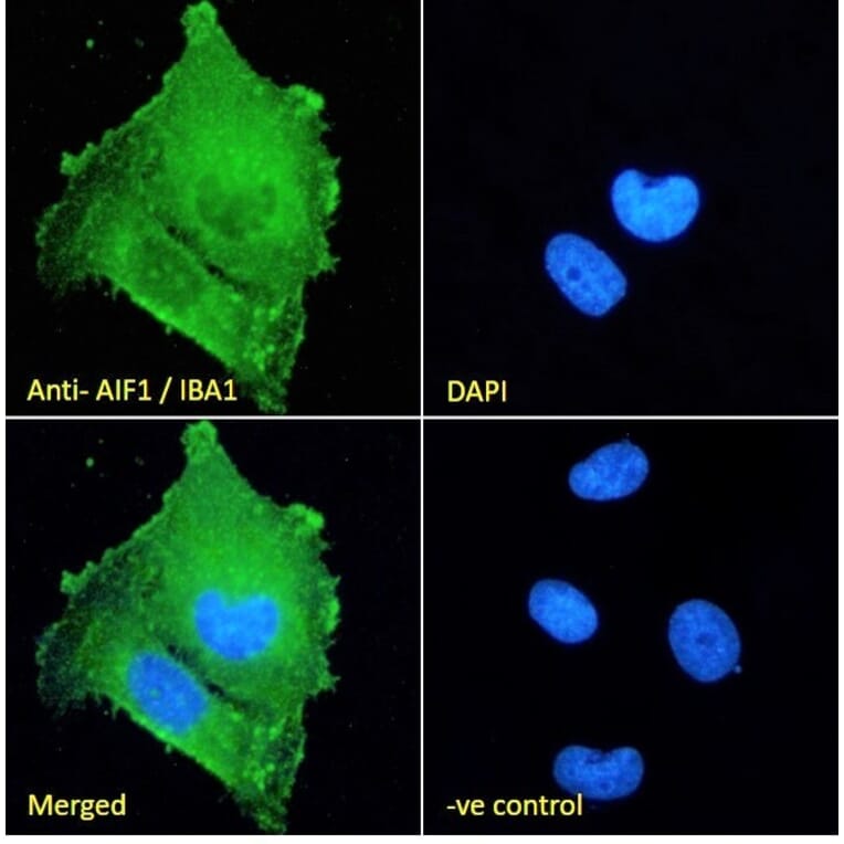 Immunofluorescence - Anti-Iba1 Antibody (A83214) - Antibodies.com