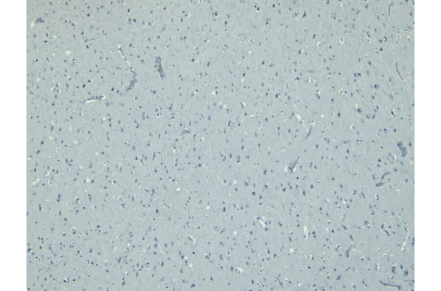Immunohistochemistry - Anti-Iba1 Antibody (A83214) - Antibodies.com