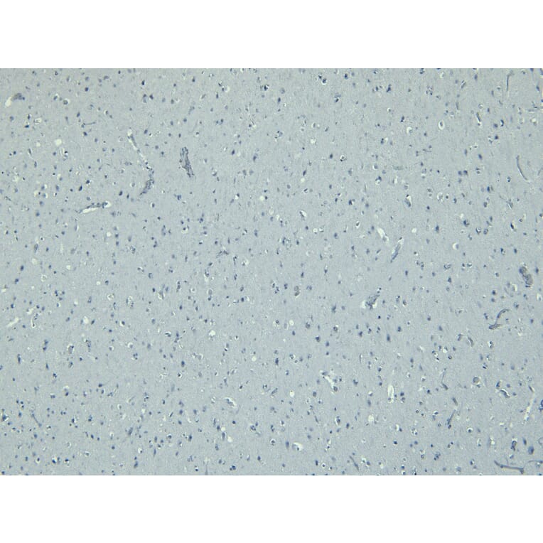 Immunohistochemistry - Anti-Iba1 Antibody (A83214) - Antibodies.com