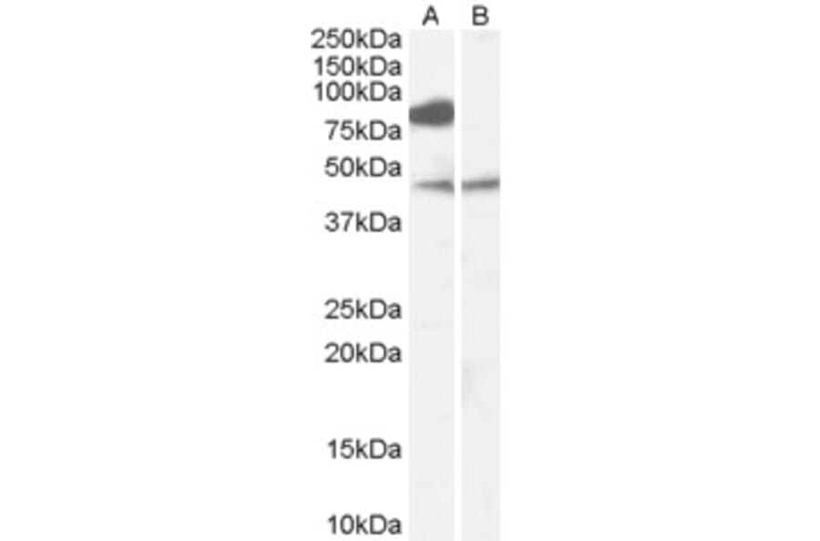 Western Blot - Anti-ZDHHC8 Antibody (A83216) - Antibodies.com