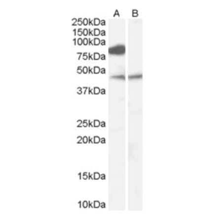 Western Blot - Anti-ZDHHC8 Antibody (A83216) - Antibodies.com