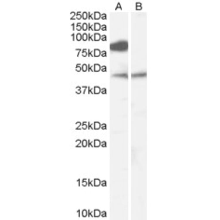 Western Blot - Anti-ZDHHC8 Antibody (A83216) - Antibodies.com