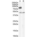 Western Blot - Anti-ZDHHC8 Antibody (A83216) - Antibodies.com