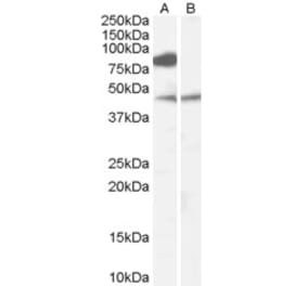 Western Blot - Anti-ZDHHC8 Antibody (A83216) - Antibodies.com