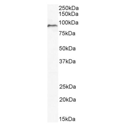 Western Blot - Anti-MS2 Antibody (A83217) - Antibodies.com