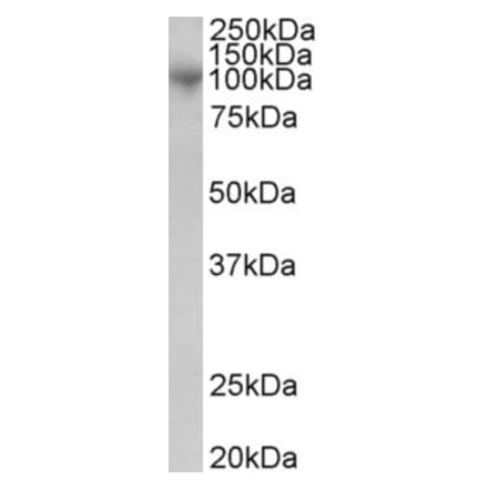 Western Blot - Anti-ADAM8 Antibody (A83217) - Antibodies.com