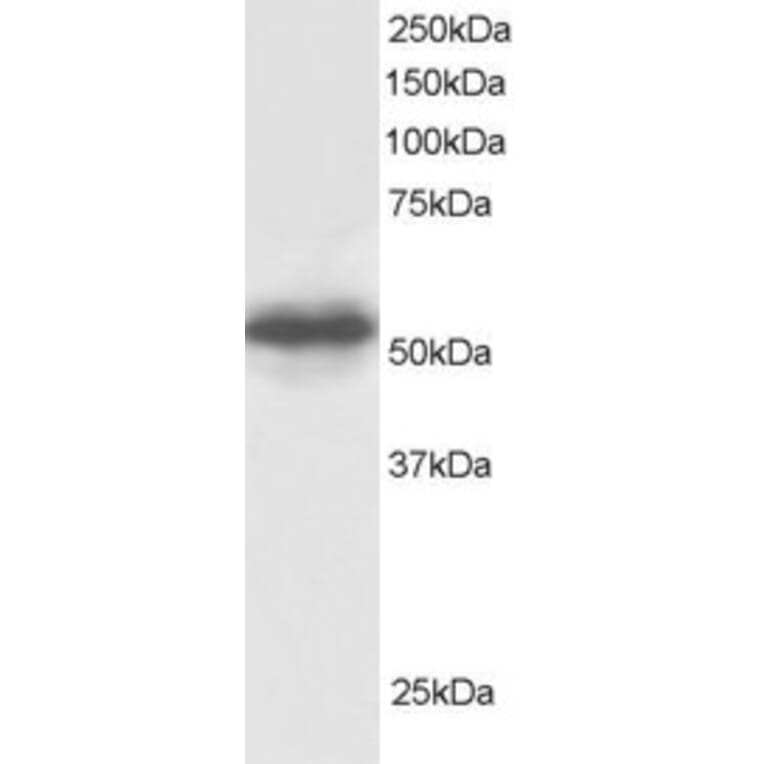 Western Blot - Anti-CSN1 Antibody (A83219) - Antibodies.com