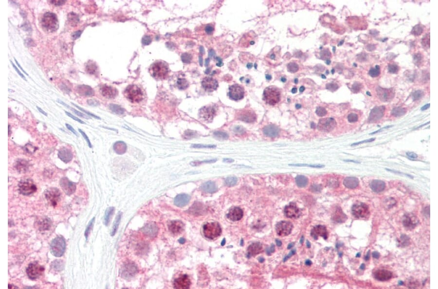 Immunohistochemistry - Anti-CSN1 Antibody (A83219) - Antibodies.com