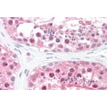 Immunohistochemistry - Anti-CSN1 Antibody (A83219) - Antibodies.com