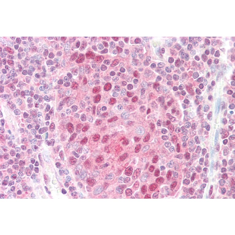 Immunohistochemistry - Anti-CSN1 Antibody (A83219) - Antibodies.com