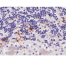 Immunohistochemistry - Anti-Iba1 Antibody (A83222) - Antibodies.com