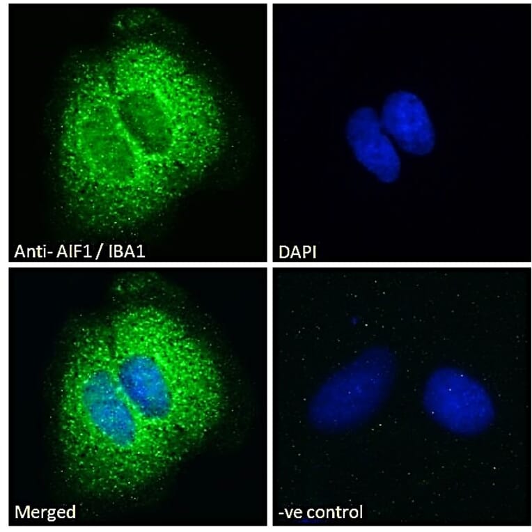 Immunofluorescence - Anti-Iba1 Antibody (A83222) - Antibodies.com