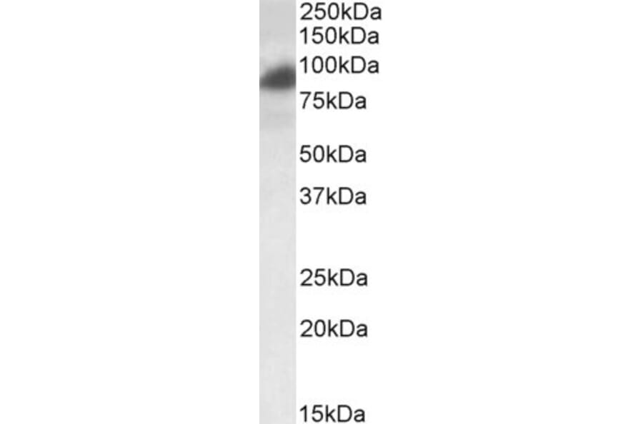 Western Blot - Anti-RAB11FIP1 Antibody (A83223) - Antibodies.com