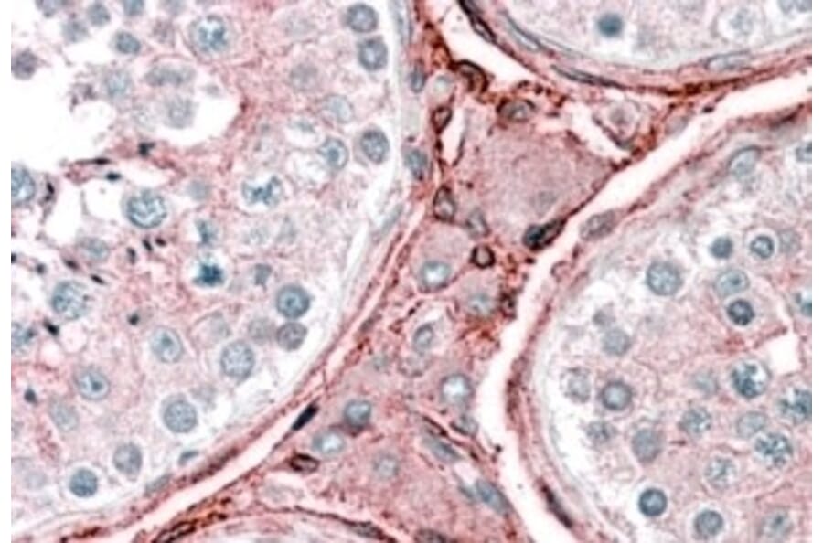 Immunohistochemistry - Anti-Cytochrome b Reductase 1/DCYTB Antibody (A83224) - Antibodies.com
