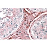 Immunohistochemistry - Anti-Cytochrome b Reductase 1/DCYTB Antibody (A83224) - Antibodies.com